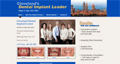 Desktop Screenshot of cleveland-dentalimplants.com